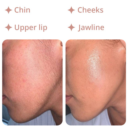 18K Hair Remover – Pro Facial Hair Removal Device